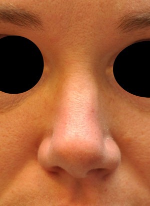 Patsient 5. Enne operatsiooni