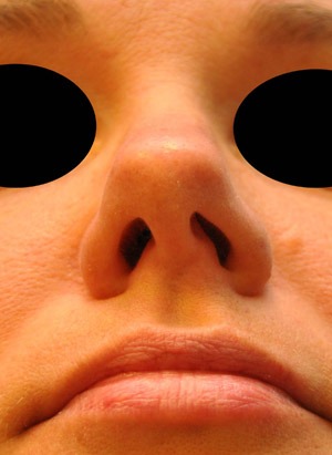 Patsient 5. Enne operatsiooni