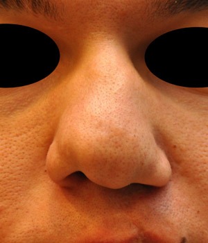 Patsient 6. Enne operatsiooni