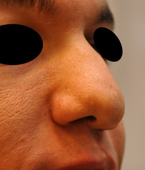 Patsient 6. Enne operatsiooni