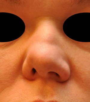 Patsient 7. Enne operatsiooni