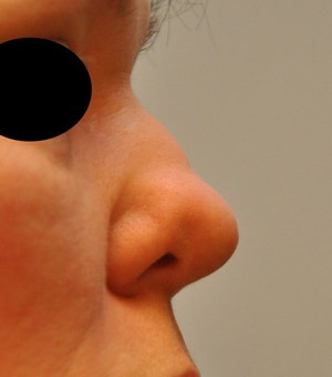 Patsient 7. Enne operatsiooni