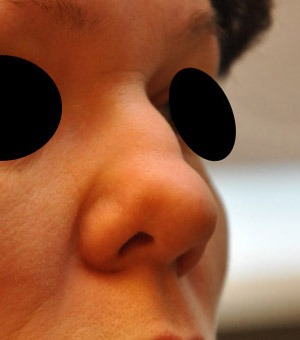 Patsient 7. Enne operatsiooni