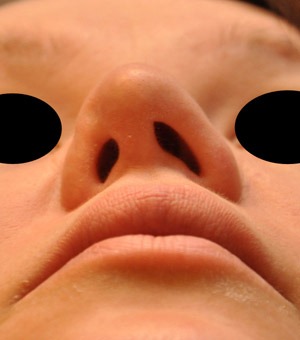 Patsient 7. Enne operatsiooni