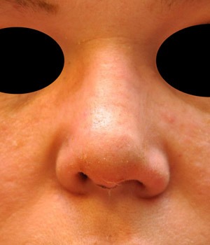 Patsient 7. Peale operatsiooni